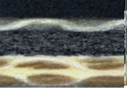 Xenon